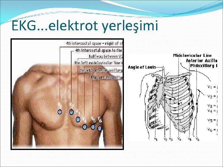 EKG. . . elektrot yerleşimi 