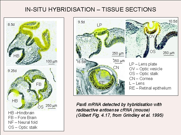IN-SITU HYBRIDISATION – TISSUE SECTIONS 9. 5 d 8. 5 d 10. 5 d
