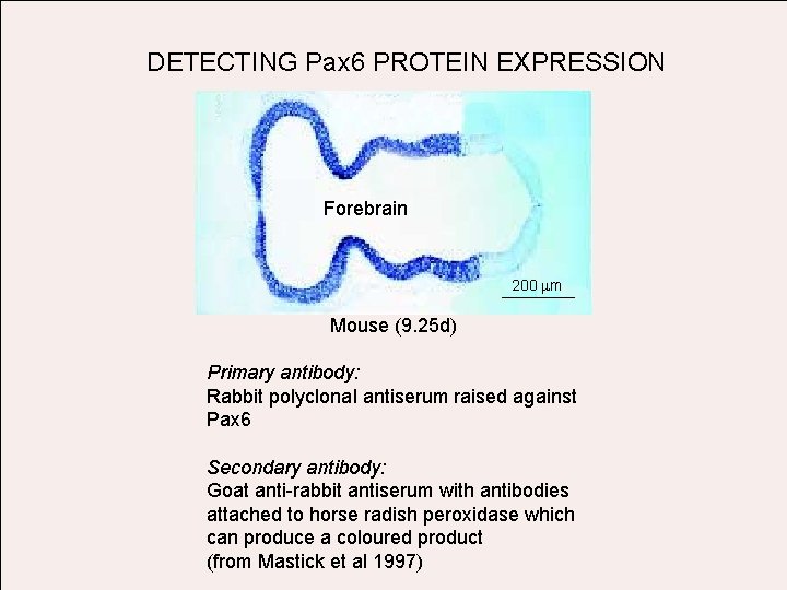 DETECTING Pax 6 PROTEIN EXPRESSION Forebrain 200 mm Mouse (9. 25 d) Primary antibody: