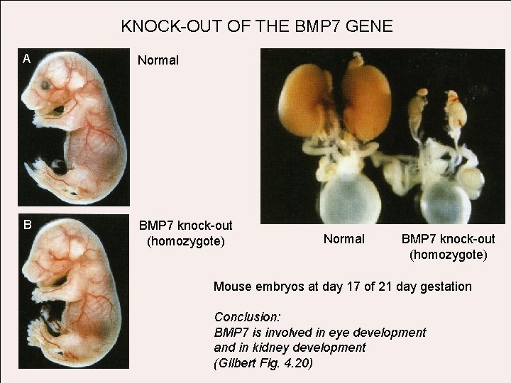 KNOCK-OUT OF THE BMP 7 GENE A Normal B BMP 7 knock-out (homozygote) Normal