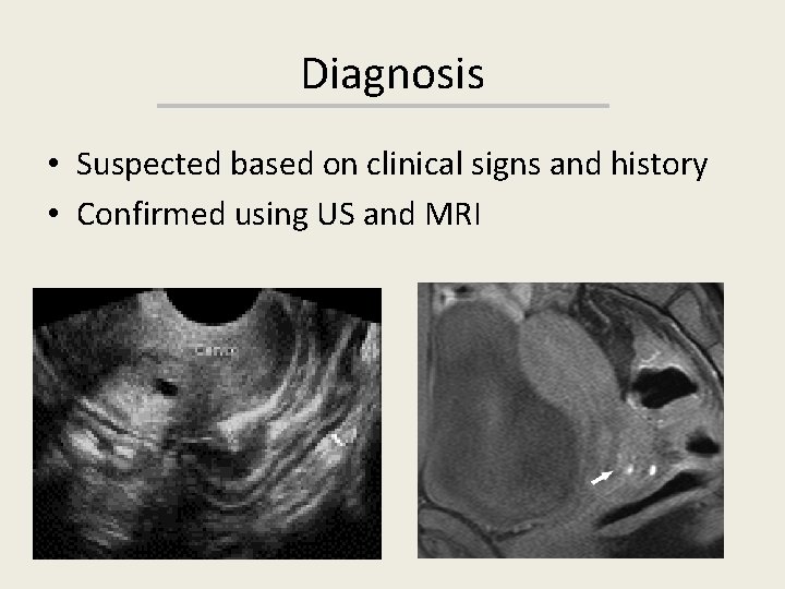 Diagnosis • Suspected based on clinical signs and history • Confirmed using US and