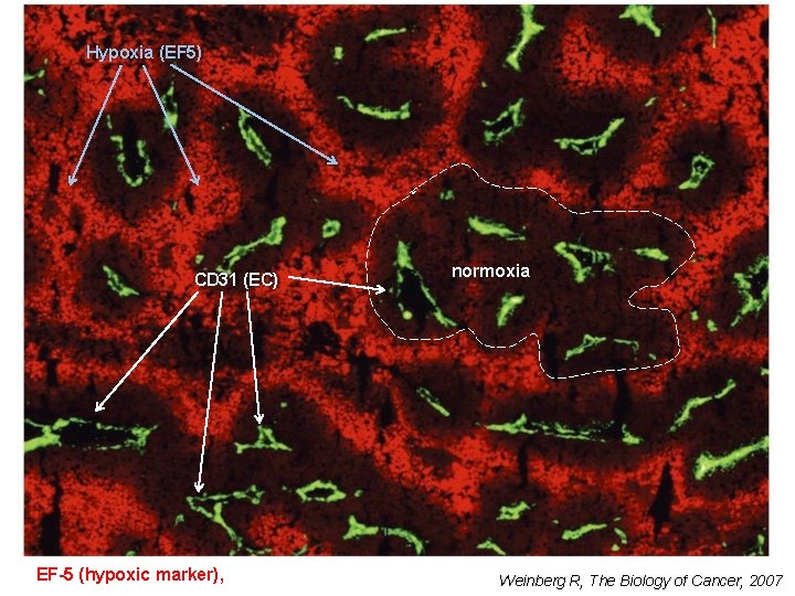 Hypoxia (EF 5) CD 31 (EC) EF-5 (hypoxic marker), normoxia Weinberg R, The Biology