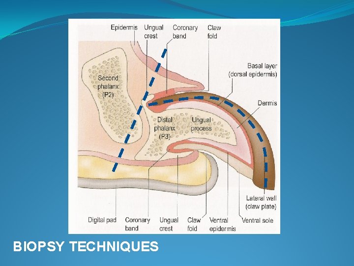 BIOPSY TECHNIQUES 