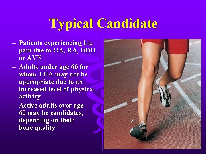 Typical Candidate – Patients experiencing hip pain due to OA, RA, DDH or AVN