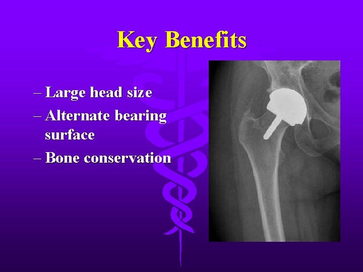 Key Benefits – Large head size – Alternate bearing surface – Bone conservation 