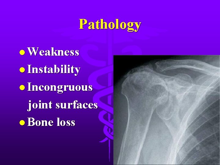 Pathology l Weakness l Instability l Incongruous joint surfaces l Bone loss 