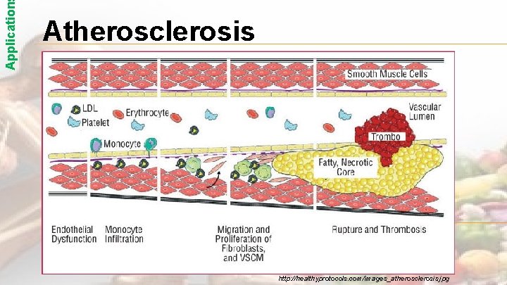 Application Atherosclerosis http: //healthyprotocols. com/images_atherosclerosis. jpg 