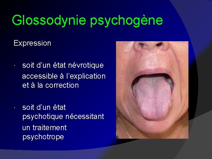 Glossodynie psychogène Expression soit d’un état névrotique accessible à l’explication et à la correction
