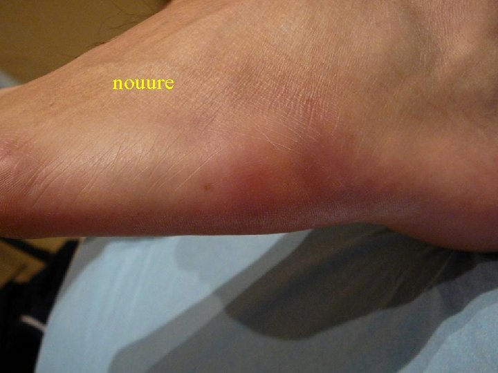 nouure 