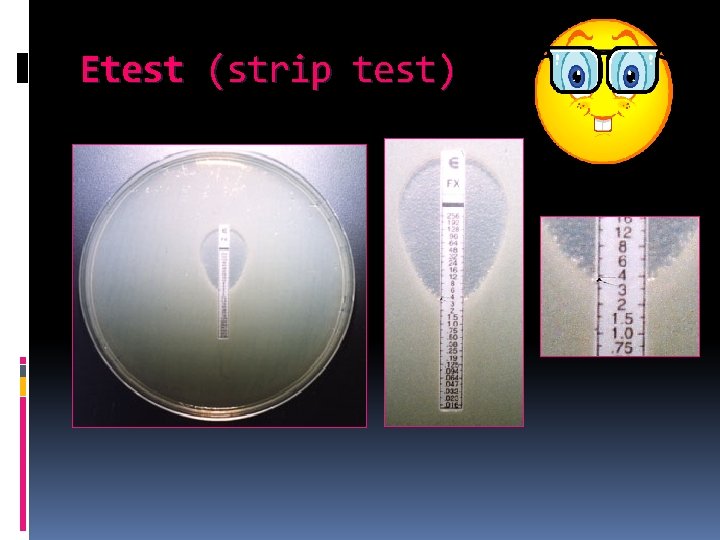 Etest (strip test) 