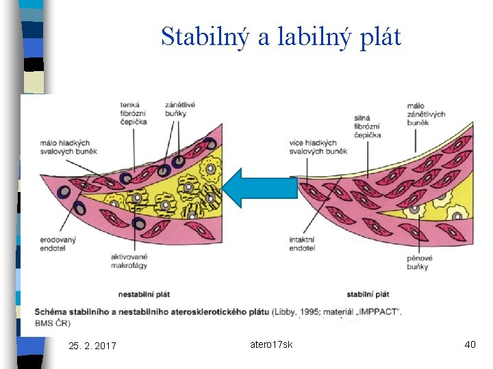 Stabilný a labilný plát 25. 2. 2017 atero 17 sk 40 