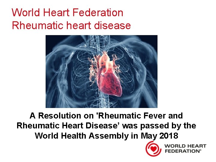 World Heart Federation Rheumatic heart disease A Resolution on 'Rheumatic Fever and Rheumatic Heart