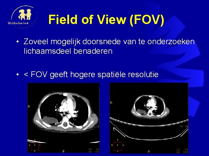 Field of View (FOV) • Zoveel mogelijk doorsnede van te onderzoeken lichaamsdeel benaderen •