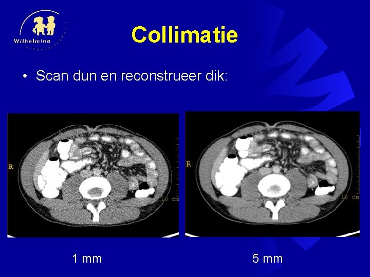 Collimatie • Scan dun en reconstrueer dik: 1 mm 5 mm 