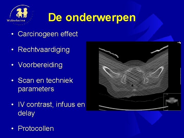 De onderwerpen • Carcinogeen effect • Rechtvaardiging • Voorbereiding • Scan en techniek parameters