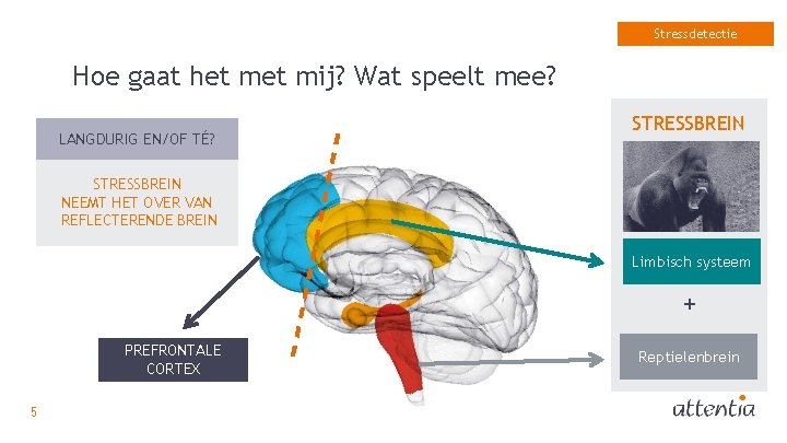 Stressdetectie Hoe gaat het mij? Wat speelt mee? LANGDURIG EN/OF TÉ? STRESSBREIN NEEMT HET