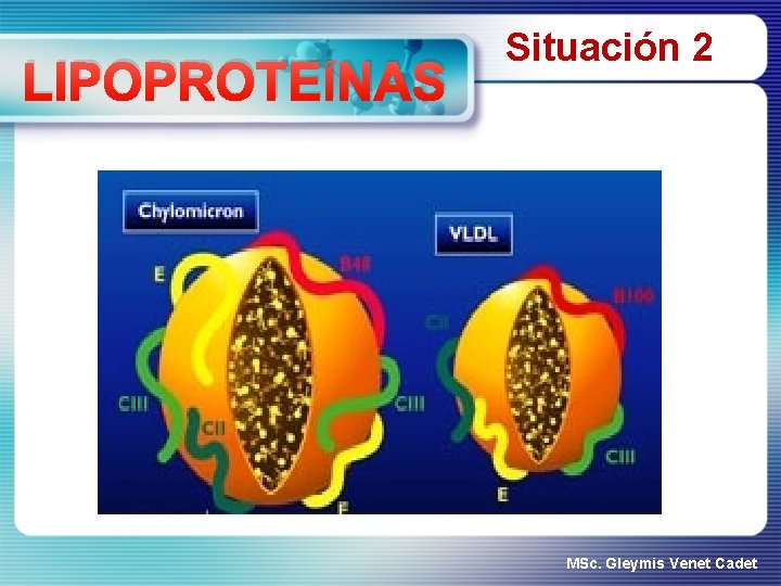 LIPOPROTEÍNAS Situación 2 MSc. Gleymis Venet Cadet 