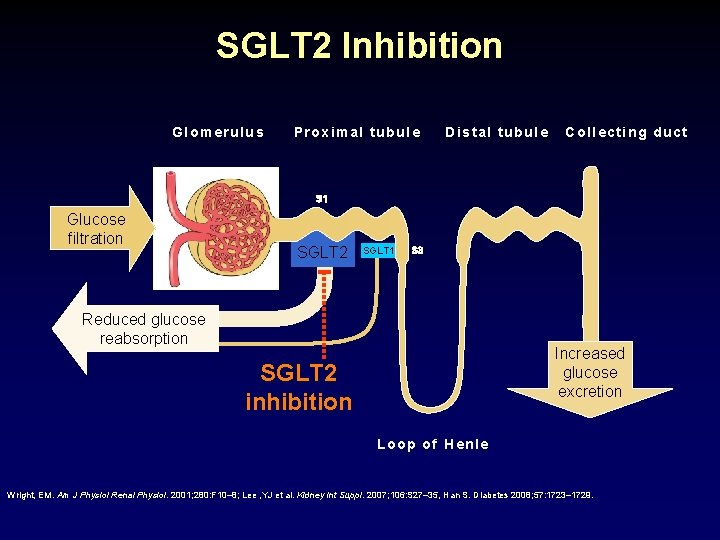 SGLT 2 Inhibition Glomerulus Proximal tubule Distal tubule Collecting duct S 1 Glucose filtration
