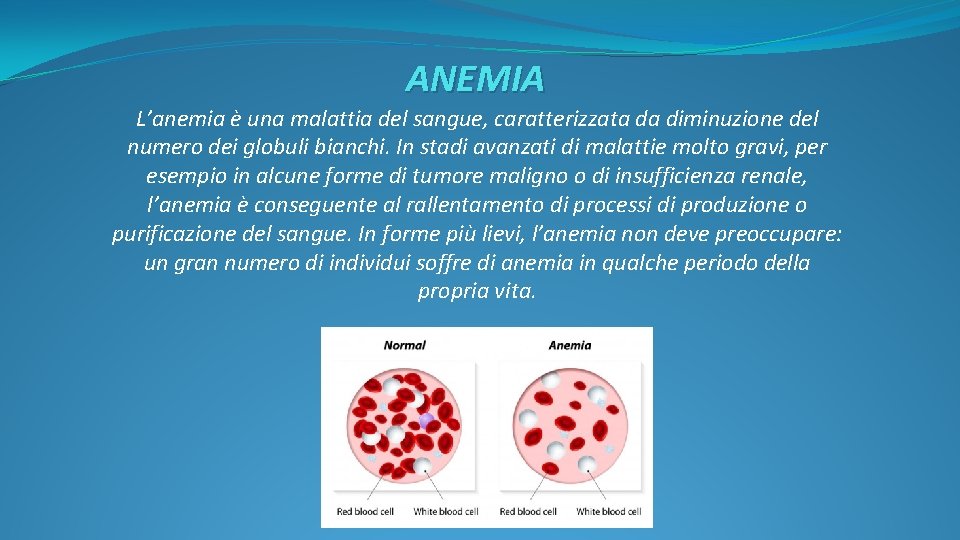 ANEMIA L’anemia è una malattia del sangue, caratterizzata da diminuzione del numero dei globuli