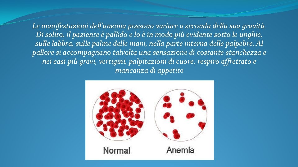 Le manifestazioni dell’anemia possono variare a seconda della sua gravità. Di solito, il paziente