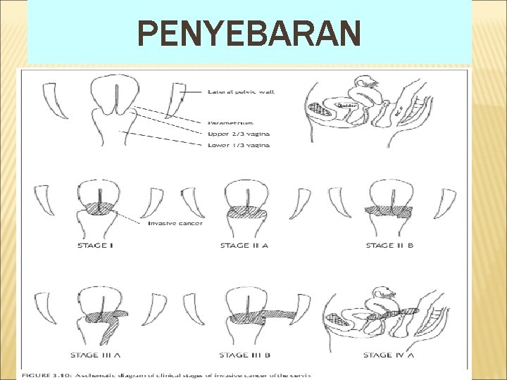 PENYEBARAN 