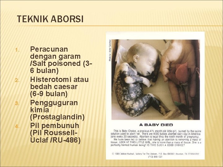 TEKNIK ABORSI 1. 2. 3. 4. Peracunan dengan garam /Salt poisoned (36 bulan) Histerotomi