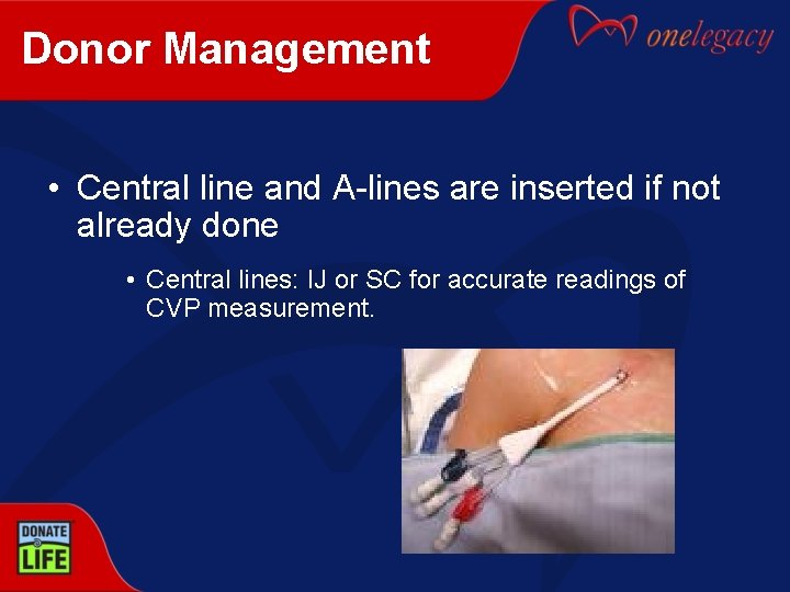 Donor Management • Central line and A-lines are inserted if not already done •