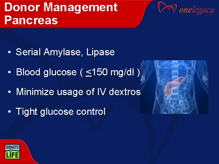 Donor Management Pancreas • Serial Amylase, Lipase • Blood glucose ( <150 mg/dl )