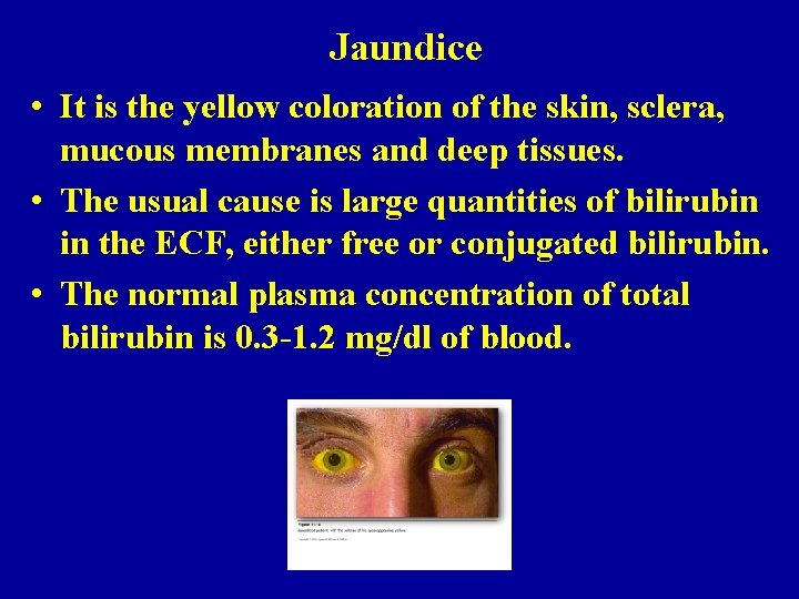 Jaundice • It is the yellow coloration of the skin, sclera, mucous membranes and