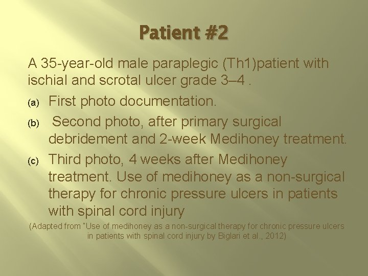 Patient #2 A 35 -year-old male paraplegic (Th 1)patient with ischial and scrotal ulcer