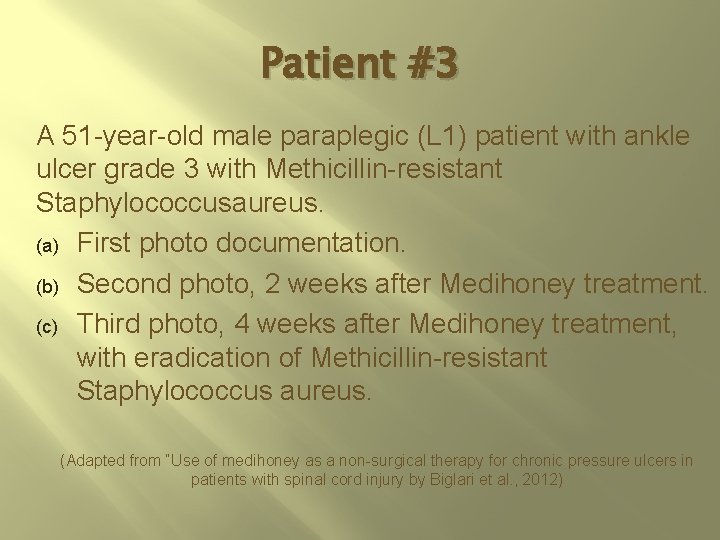Patient #3 A 51 -year-old male paraplegic (L 1) patient with ankle ulcer grade