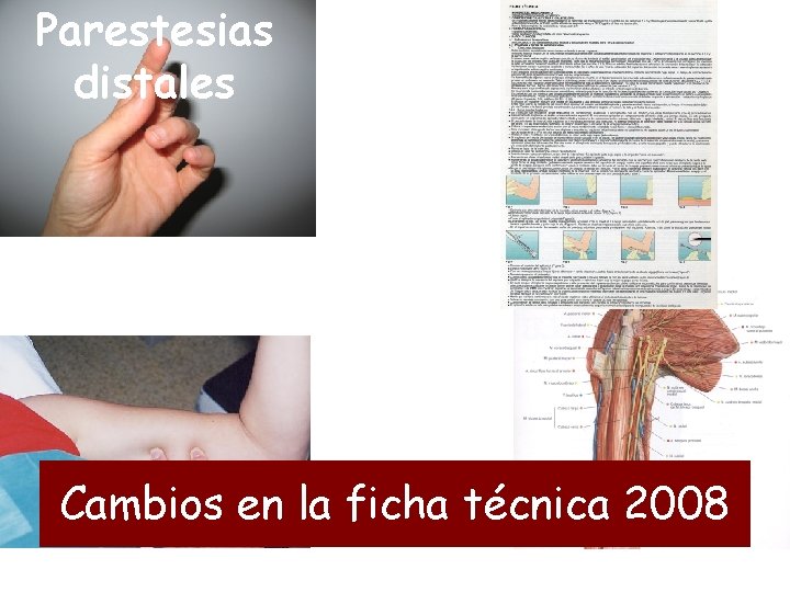 Parestesias distales Cambios en la ficha técnica 2008 