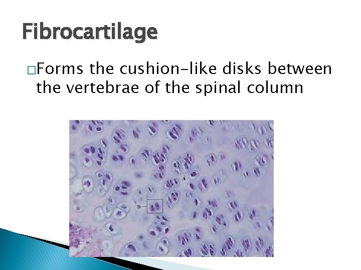 Fibrocartilage �Forms the cushion-like disks between the vertebrae of the spinal column 