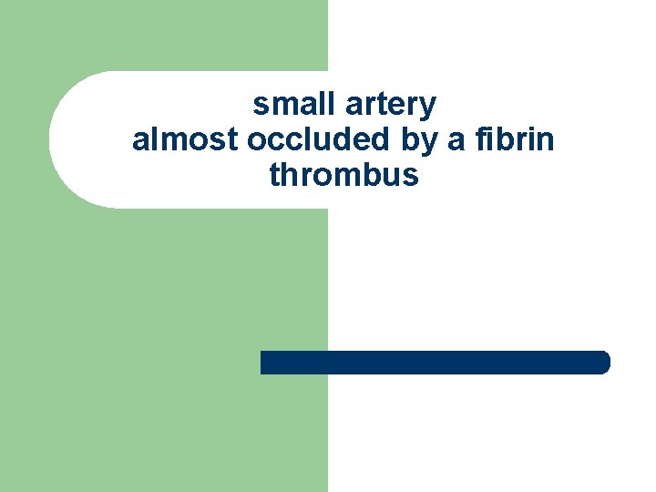 small artery almost occluded by a fibrin thrombus small artery almost occluded by a fibrin thrombus