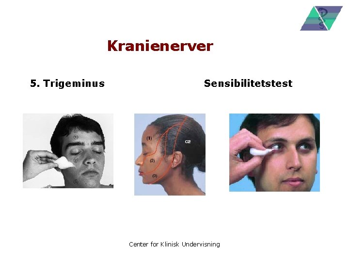 Kranienerver 5. Trigeminus Sensibilitetstest Center for Klinisk Undervisning 