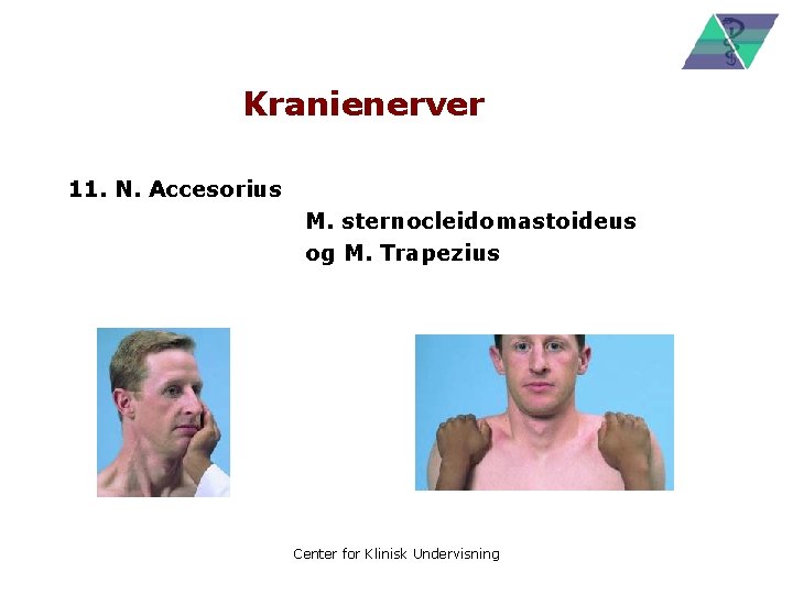 Kranienerver 11. N. Accesorius M. sternocleidomastoideus og M. Trapezius Center for Klinisk Undervisning 