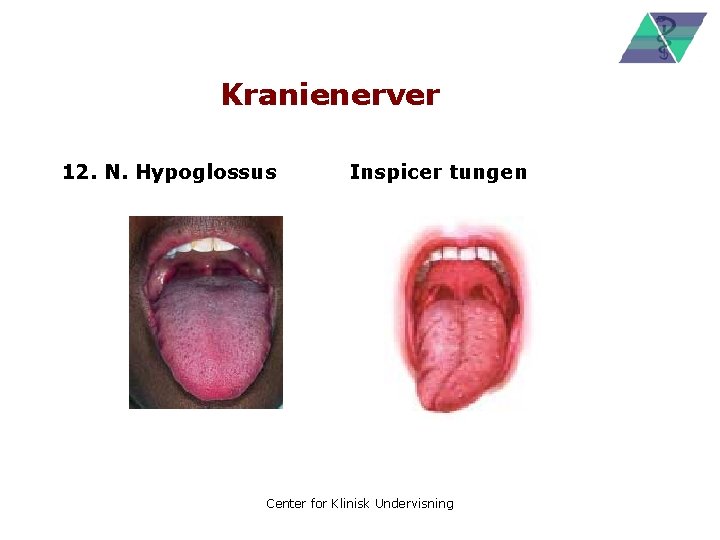 Kranienerver 12. N. Hypoglossus Inspicer tungen Center for Klinisk Undervisning 