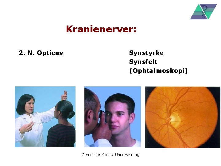 Kranienerver: 2. N. Opticus Synstyrke Synsfelt (Ophtalmoskopi) Center for Klinisk Undervisning 