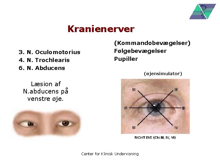 Kranienerver 3. N. Oculomotorius 4. N. Trochlearis 6. N. Abducens (Kommandobevægelser) Følgebevægelser Pupiller (øjensimulator)