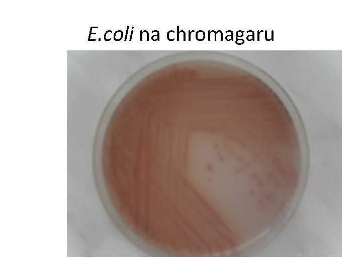 E. coli na chromagaru 