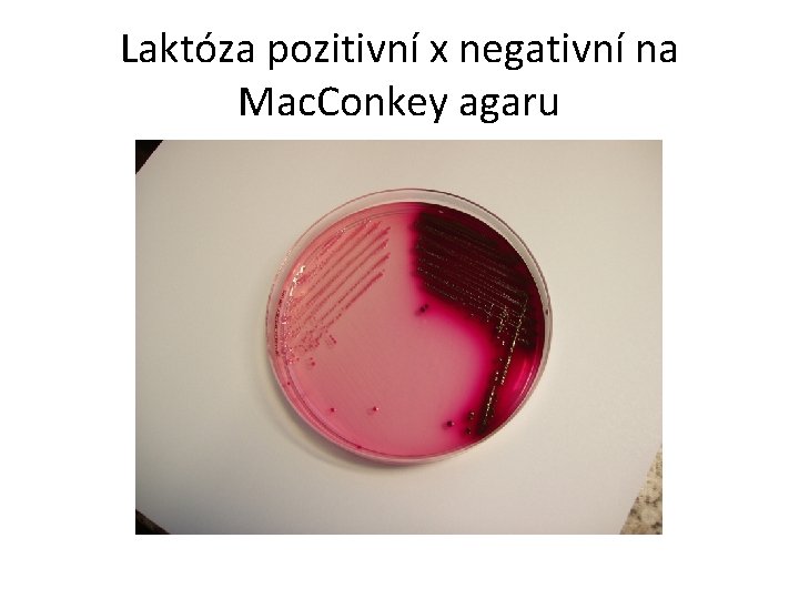 Laktóza pozitivní x negativní na Mac. Conkey agaru 