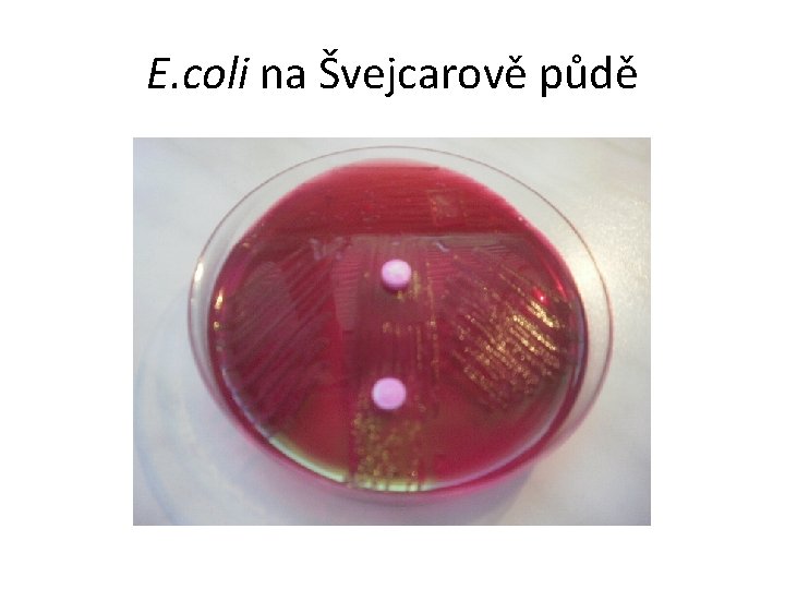 E. coli na Švejcarově půdě 