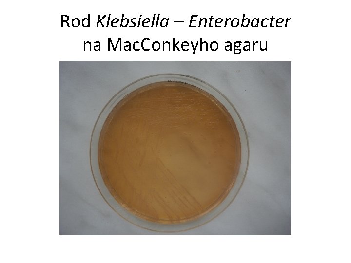 Rod Klebsiella – Enterobacter na Mac. Conkeyho agaru 