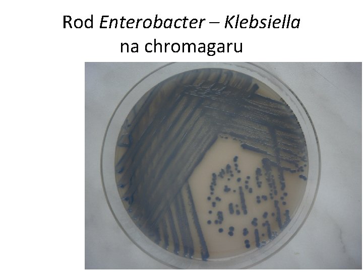 Rod Enterobacter – Klebsiella na chromagaru 