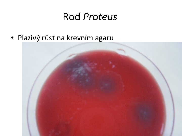 Rod Proteus • Plazivý růst na krevním agaru 