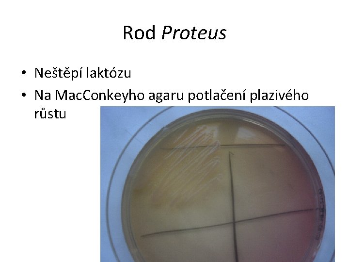 Rod Proteus • Neštěpí laktózu • Na Mac. Conkeyho agaru potlačení plazivého růstu 