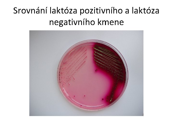 Srovnání laktóza pozitivního a laktóza negativního kmene 