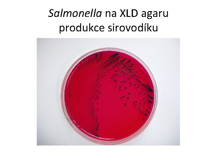 Salmonella na XLD agaru produkce sirovodíku 