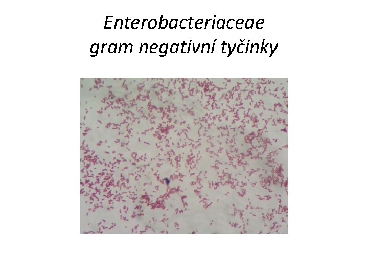 Enterobacteriaceae gram negativní tyčinky 