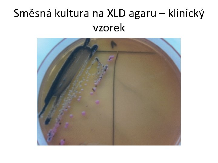 Směsná kultura na XLD agaru – klinický vzorek 